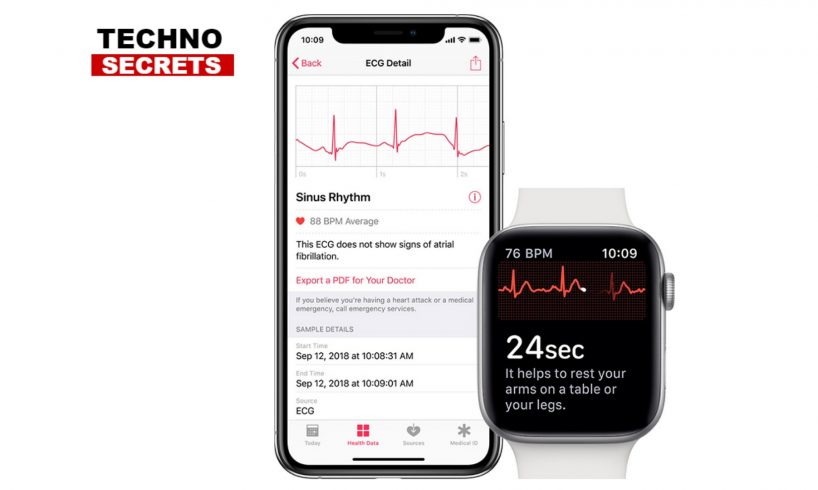 Apple WatchOS 5.1.2: new updates with ECG and much more.