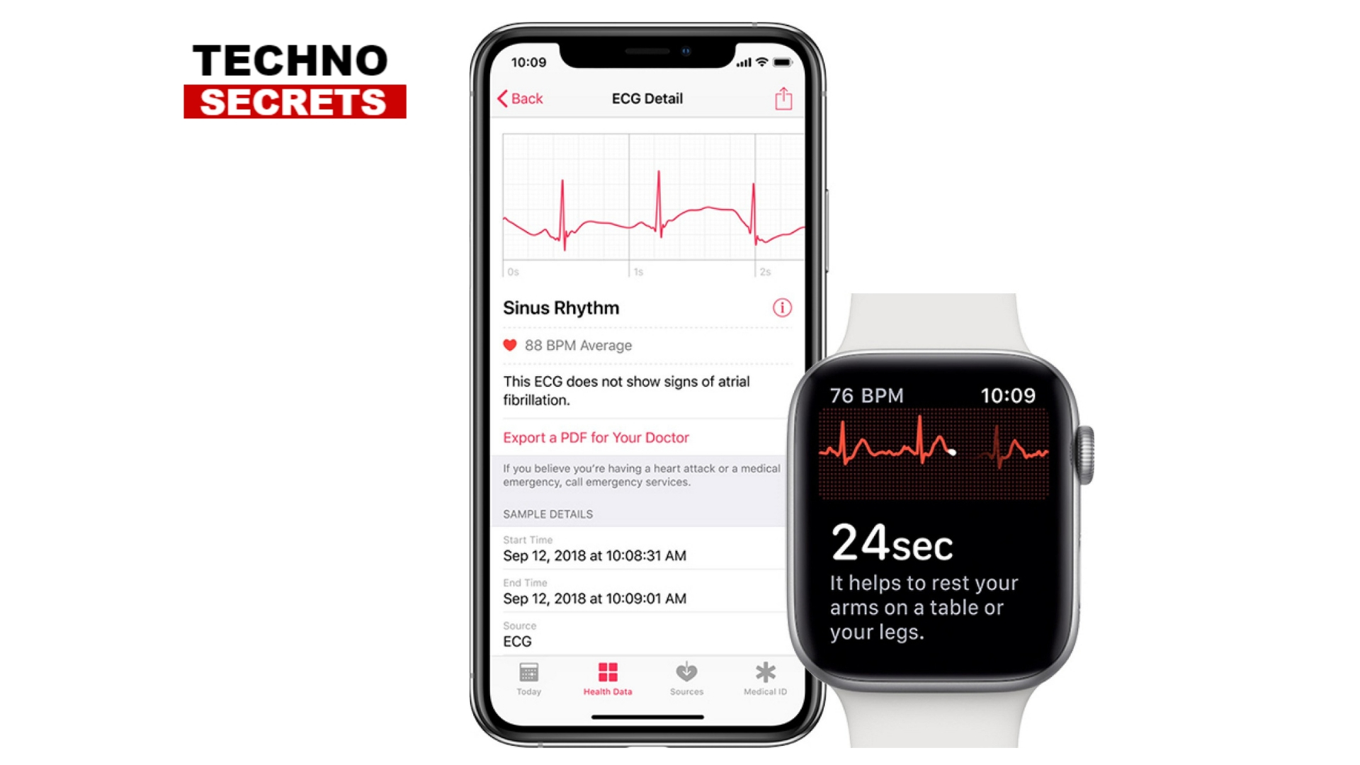 Apple WatchOS 5.1.2: new updates with ECG and much more.