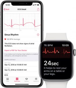 Apple WatchOS 5.1.2: new updates with ECG and much more.